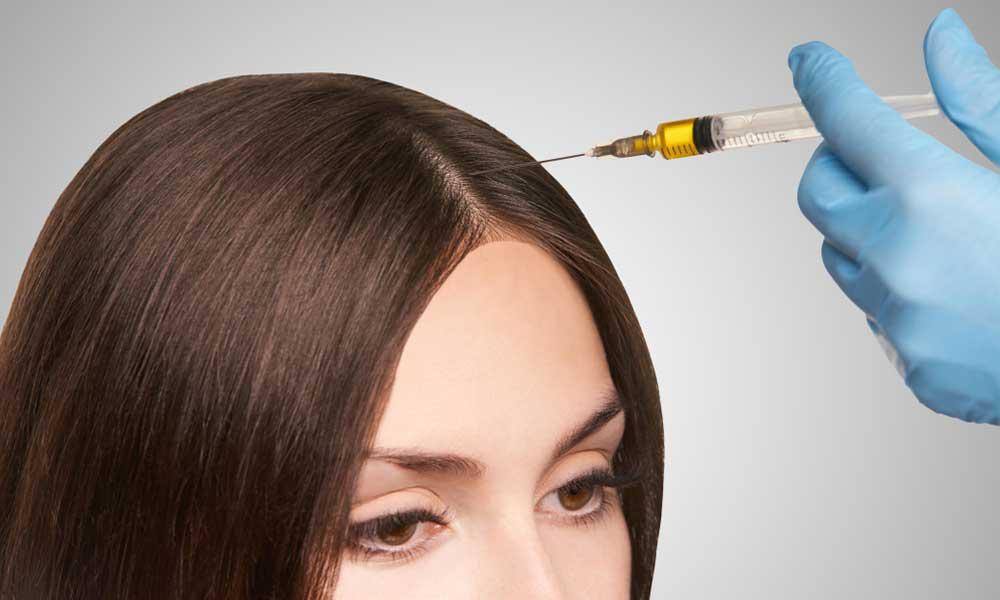 Eight Things You Need To Know Before Getting PRP Hair Restoration